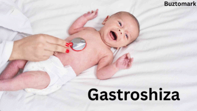 gastroshiza